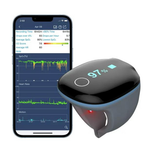 Wellue O2Ring Wearable Sleep Monitor & Health Tracker